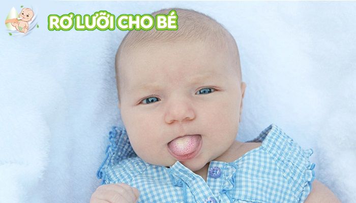 dấu hiệu nhân biết trẻ bị tưa lưỡi