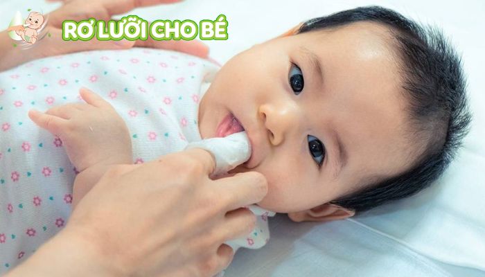 thuốc ro lưỡi nystatin thao tác nhẹ nhàng hạn chế tổn thương miệng bé