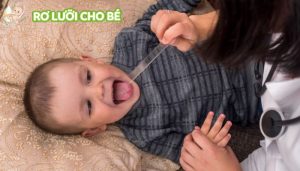 Nấm lưỡi ở trẻ 3 tuổi do chưa được vệ sinh đúng cách